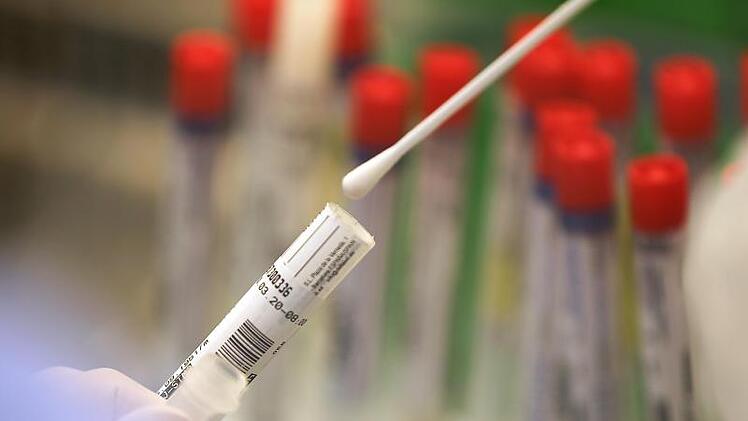 Ein Abstrich wird in einem Labor auf das Coronavirus untersucht