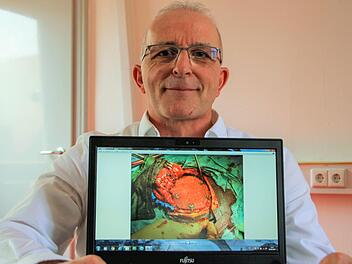 Das Implantat am Schädelknochen (Computer-Bildschirm) sorgt dafür, dass man von außen keine "Delle" in Detlef Postlers Kopf sieht. Foto: Diana Fuchs