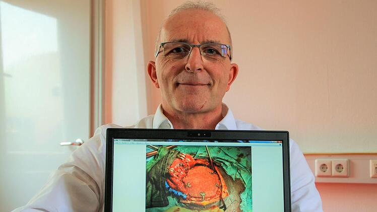 Das Implantat am Schädelknochen (Computer-Bildschirm) sorgt dafür, dass man von außen keine "Delle" in Detlef Postlers Kopf sieht. Foto: Diana Fuchs