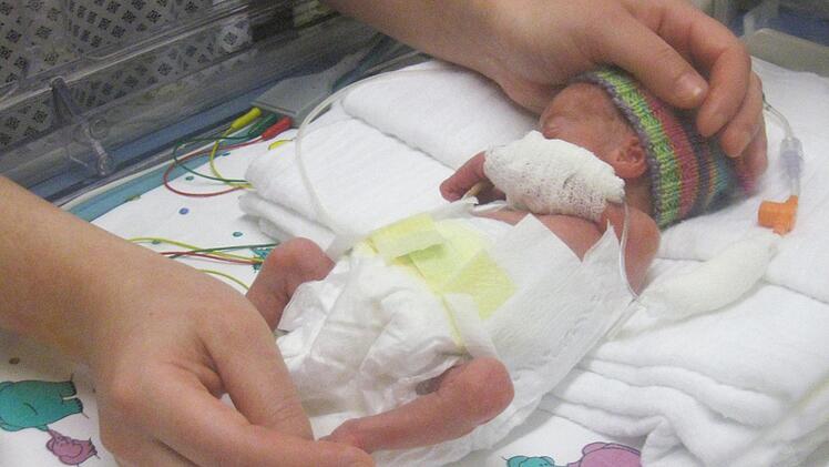 Mit nur 620 Gramm kam Finn auf die Welt. Foto: privat