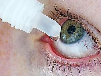 Bei Augentropfen gilt: Weniger ist mehr. Denn träufelt man zu viel, wird die Flüssigkeit zu schnell abtransportiert.  Foto: Bodo Marks/dpa-mag