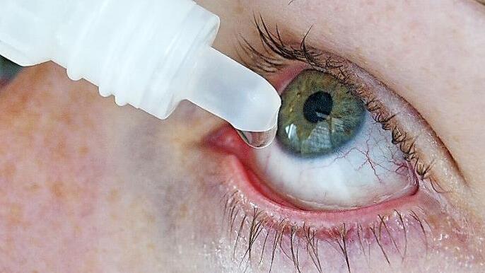 Bei Augentropfen gilt: Weniger ist mehr. Denn träufelt man zu viel, wird die Flüssigkeit zu schnell abtransportiert.  Foto: Bodo Marks/dpa-mag