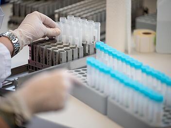 Bei Screeings von PCR-Tests sind nun die ersten beiden Omikron-Fälle in Kulmbach aufgetaucht.