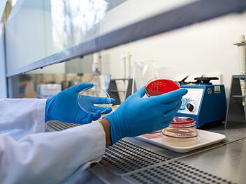 Ehec-Infektionen 2025: So schützt du dich vor den gefährlichen Bakterien