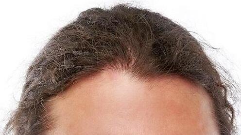 Frank Hertel(Die Linke)