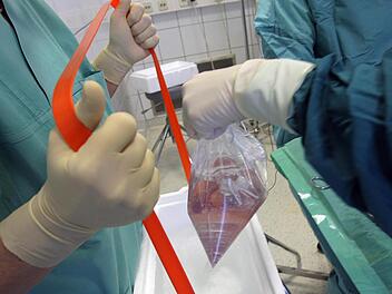 Das Foto zeigt die Entnahme einer Niere, die für eine Transplantation vorgesehen ist. Foto: Jan-Peter Kasper/dpa-Archiv
