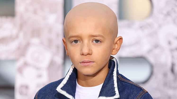 Dexter Sol Ansell musste f&uuml;r seine Rolle als Egg Haare lassen ...