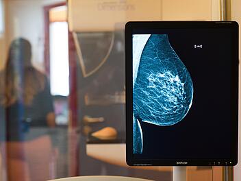 Brustkrebs ist in Deutschland die mit Abstand häufigste Krebserkrankung bei Frauen. Jedes Jahr gibt es rund 69 000 Neuerkrankungen. Geht es nach Christine Kiendl von der Kronacher Selbsthilfegruppe "Franca" suchen vor allem junge Frauen nach der Diagnose in erster Linie im Internet Rat - und nicht mehr im persönlichen Gespräch.  Foto: Klaus-Dietmar Gabbert/dpa