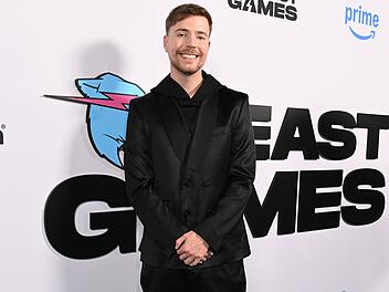 YouTube-Star MrBeast ist auf dem rechten Auge fast blind.