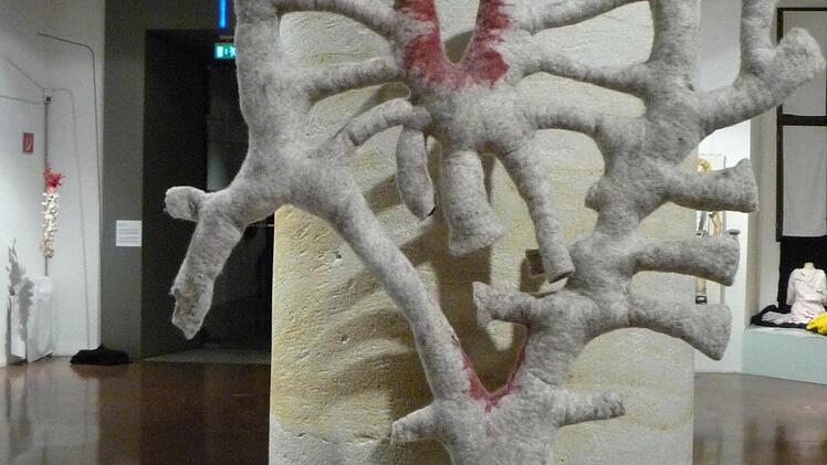 "Arterienbogen"