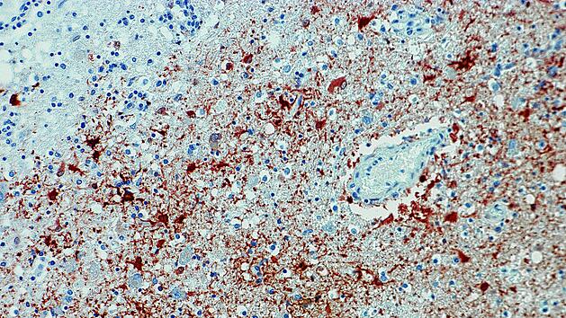 Borna-Virus in Pfaffenhofen: Zwei Infizierte, ein Todesfall – So gefährlich ist das Virus