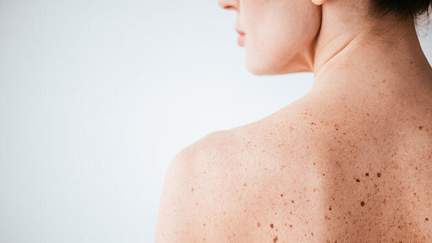 Haut, R&uuml;cken, Hautpflege