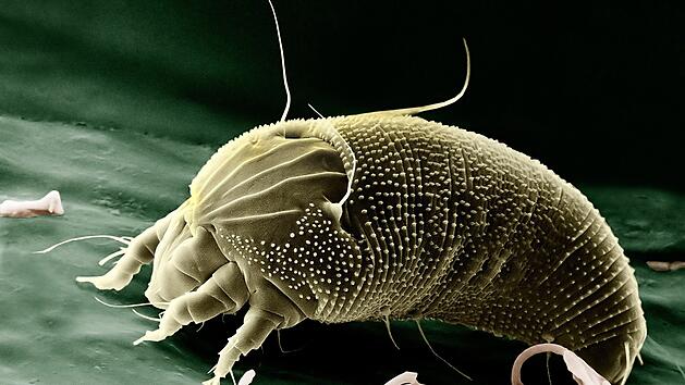 Wusstest du, dass Milben auch auf unserem Gesicht leben? Hier sind zw&ouml;lf kuriose Fakten &uuml;ber den menschlichen K&ouml;rper.