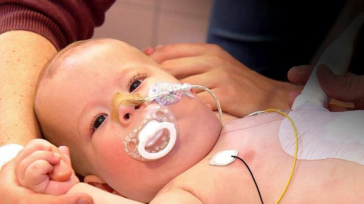 Lukas (10 Monate) ist der weltweit jüngste Patient mit einem Kunstherzantrieb. Im Klinikum Erlangen wartet er auf ein passendes Spenderorgan. Foto: Männel/Klinikum Erlangen