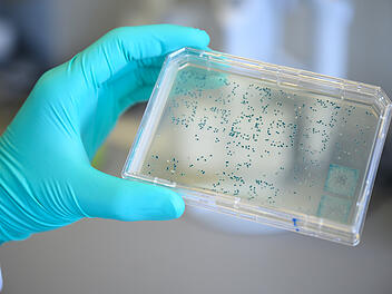 Coronavirus: Die Sterberate sinkt - das ist der Grund