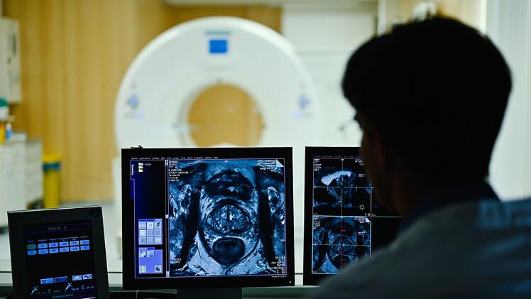 Mitarbeiter des DKFZ betrachtet Querschnittsbild einer Prostata