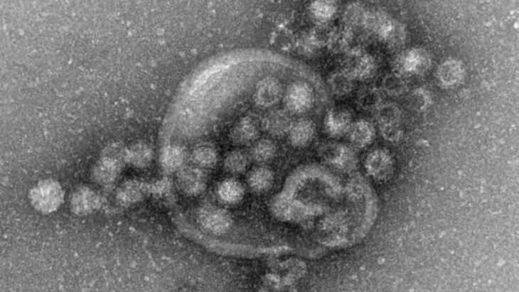 Elektronenmikroskopische Aufnahme von Noroviren. Das Norovirus breitet sich in diesem Winter stark aus. Allein in der Woche vor Weihnachten wurden in Deutschland 5289 Erkrankungen gemeldet, wie aus einer neuen Statistik des Robert-Koch-Instituts (RKI) hervorgeht. Foto: Gudrun Holland/RKI/Robert-Koch-Institut/dpa