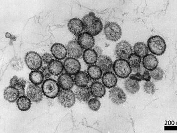 Hantavirus