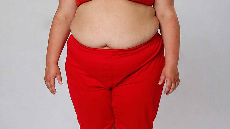 So sah Rada zu Beginn der Staffel aus: Sie wog 154,9 Kilo. Foto: SAT.1/Morris MacMatzen