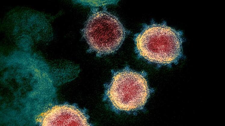 Coronavirus
