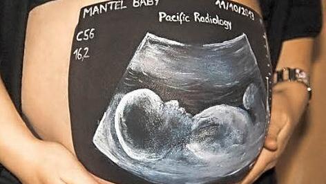 Direkt auf dem Bauch wirkt ein Ultraschallbild gleich viel anschaulicher, findet Künstlerin Alexandra Lamm.
