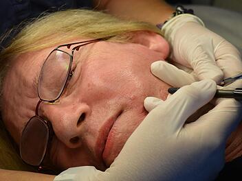 Bei der Nadelepilation wird mit einer heißen Sonde jede Haarwurzel einzeln verödet: Für Transfrauen ist das bislang die einzige Möglichkeit ihre Gesichtsbehaarung dauerhaft loszuwerden.
