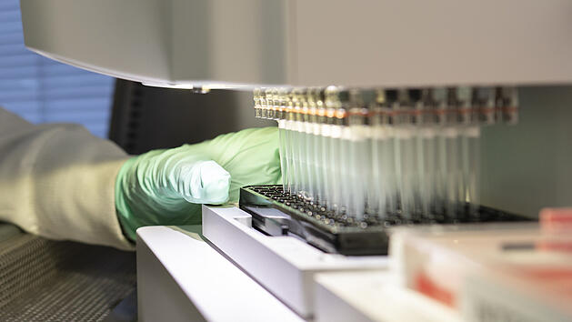 US-Arzneimittelbehörde lässt Alzheimer-Medikament zu