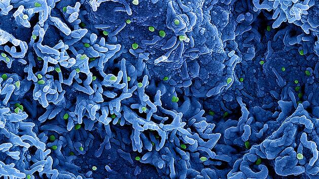 Neue Mpox-Variante grassiert: WHO ruft weltweite Notlage aus