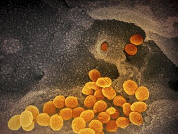 Coronavirus, Corona, Virus, Elektronenmikroskop