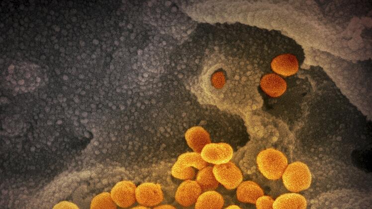 Coronavirus, Corona, Virus, Elektronenmikroskop