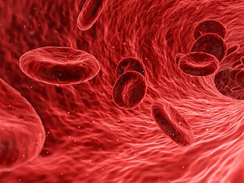 Verstopfte Arterien - Rolle Cholesterin