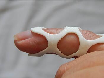 Die Fingerschiene aus ASB-Kunststoff erfüllt alle Anforderungen an Stabilität und ist gleichzeitig hygienisch.