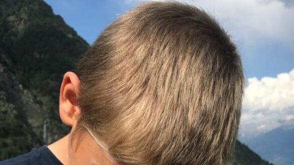 Beim Spaziergang nimmt Aaron die Welt unter die Lupe. Foto: Carmen Schwind