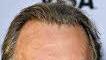 Tom Wilkinson