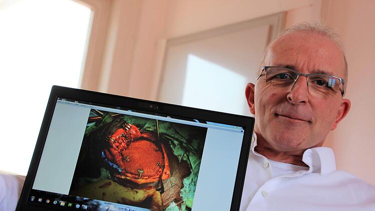 Das Implantat am Schädelknochen sorgt dafür, dass man von außen keine "Delle" in Detlef Postlers Kopf sieht. Postler