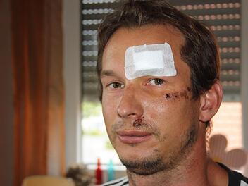 Sebastian Linz drei Tage nach der brutalen Attacke Foto: Sebastian Martin