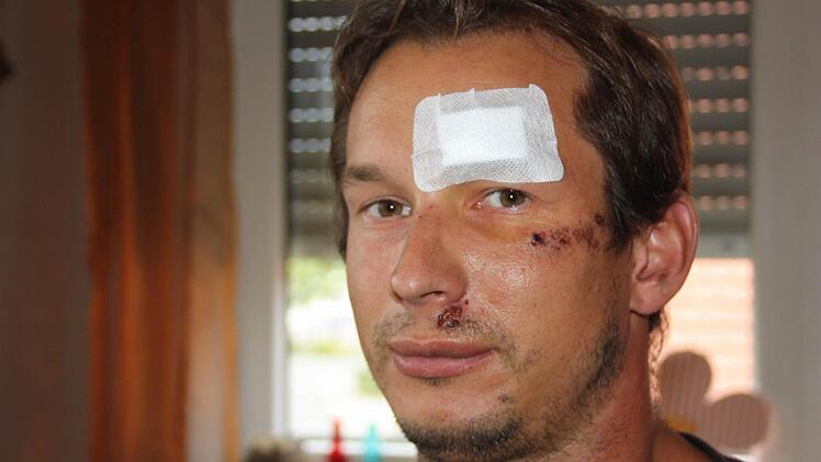 Sebastian Linz drei Tage nach der brutalen Attacke Foto: Sebastian Martin