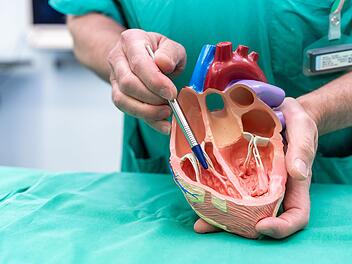 Innovativer minimalinvasiver Eingriff am Klinikum Nürnberg: Neuer Hoffnungsträger für Herzpatienten
