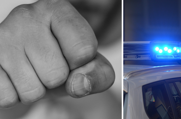 Bamberg: Mann (25) wird unvermittelt angegriffen - Zahn ausgeschlagen