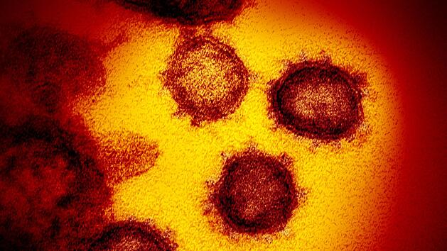Das Coronavirus Sars-CoV-2 d&uuml;rfte sich &uuml;ber kurz oder lang weiterentwickeln - neue Varianten k&ouml;nnen entstehen.