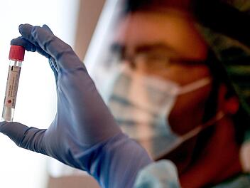 Nürnberg: Gesundheitsamt stellt Meldeprozess der Corona-Fälle um