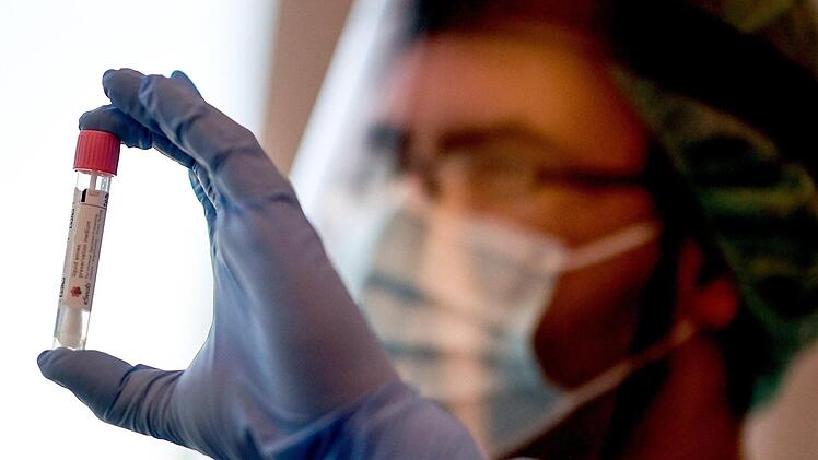 Nürnberg: Gesundheitsamt stellt Meldeprozess der Corona-Fälle um