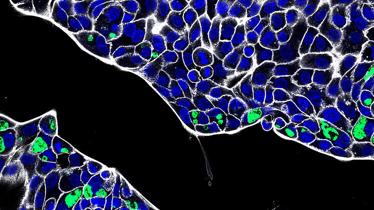 Universit&auml;t W&uuml;rzburg berichtet: Chlamydien k&ouml;nnen sich im Darm einnisten