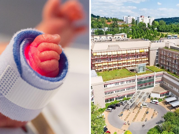 Klinikum Coburg besorgt: Perinatalzentrum k&ouml;nnte geschlossen werden