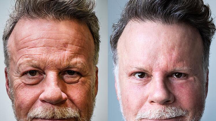 Mit seinem "Schönheits-Experiment" machte Jenke von Wilmsdorff Schlagzeilen wie mit keinem anderen Selbstversuch.