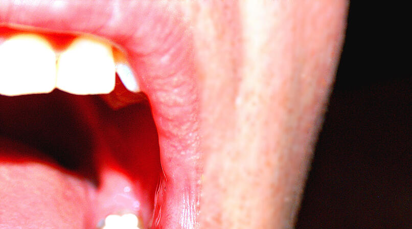 Z&auml;hne, Gebiss, bei&szlig;en, w&uuml;tend, verr&uuml;ckt, Biss