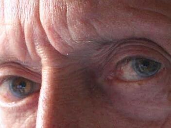 "Dementielles Syndrom" lautete vor fünf Jahren die Diagnose. Fotos: Josef Hofbauer