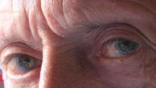 "Dementielles Syndrom" lautete vor fünf Jahren die Diagnose. Fotos: Josef Hofbauer