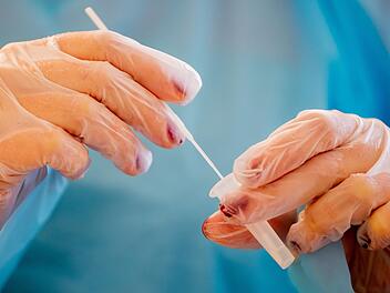 Ende der kostenlosen Coronatests?