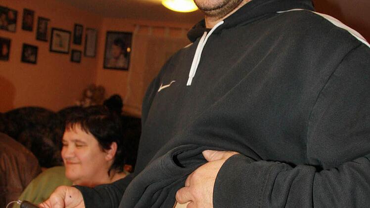 Harald Stier hängt an der Nadel - doch keine Angst: Es handelt sich um eine  Dauernadel im Bauch, verbunden mit einer Insulinpumpe.